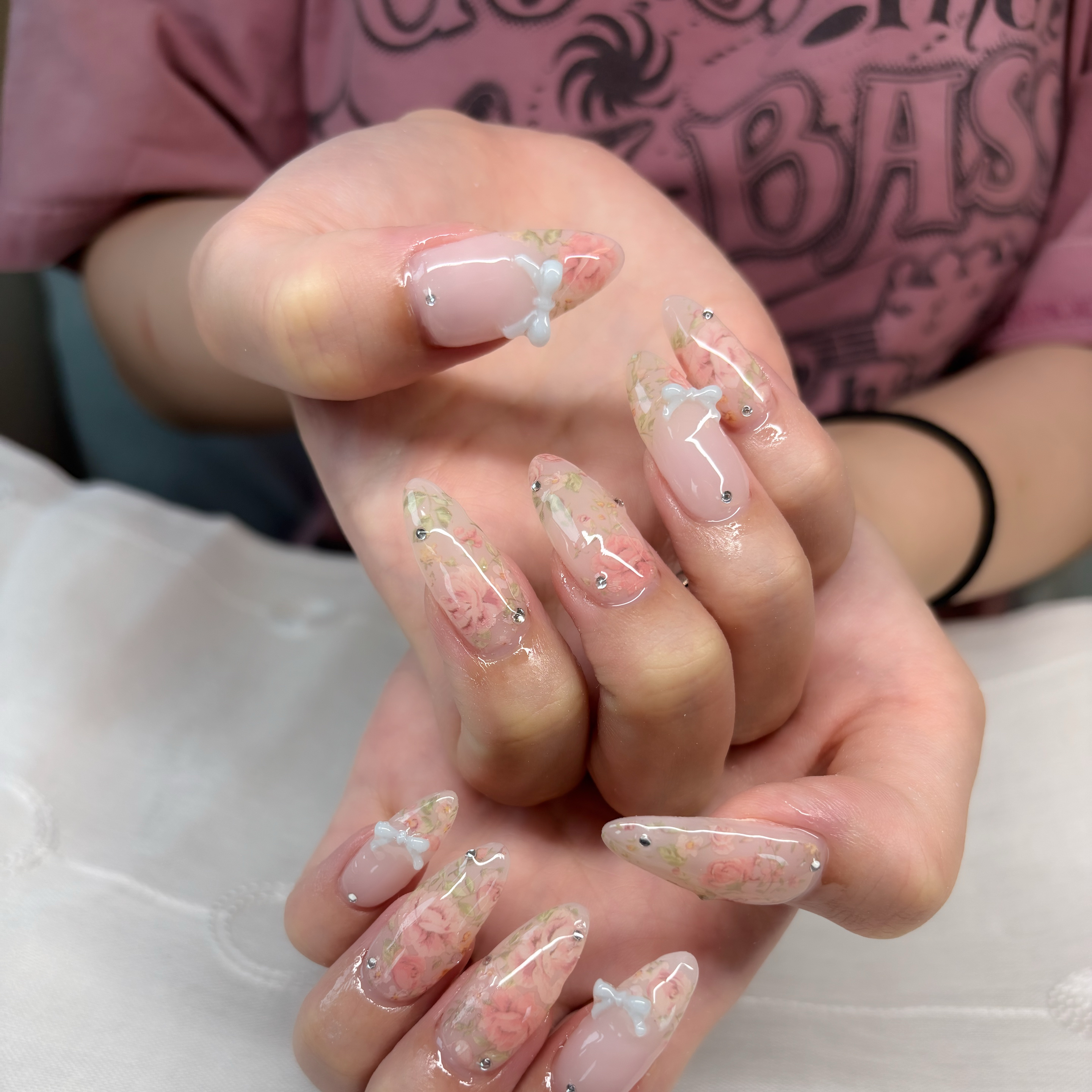 trangnail