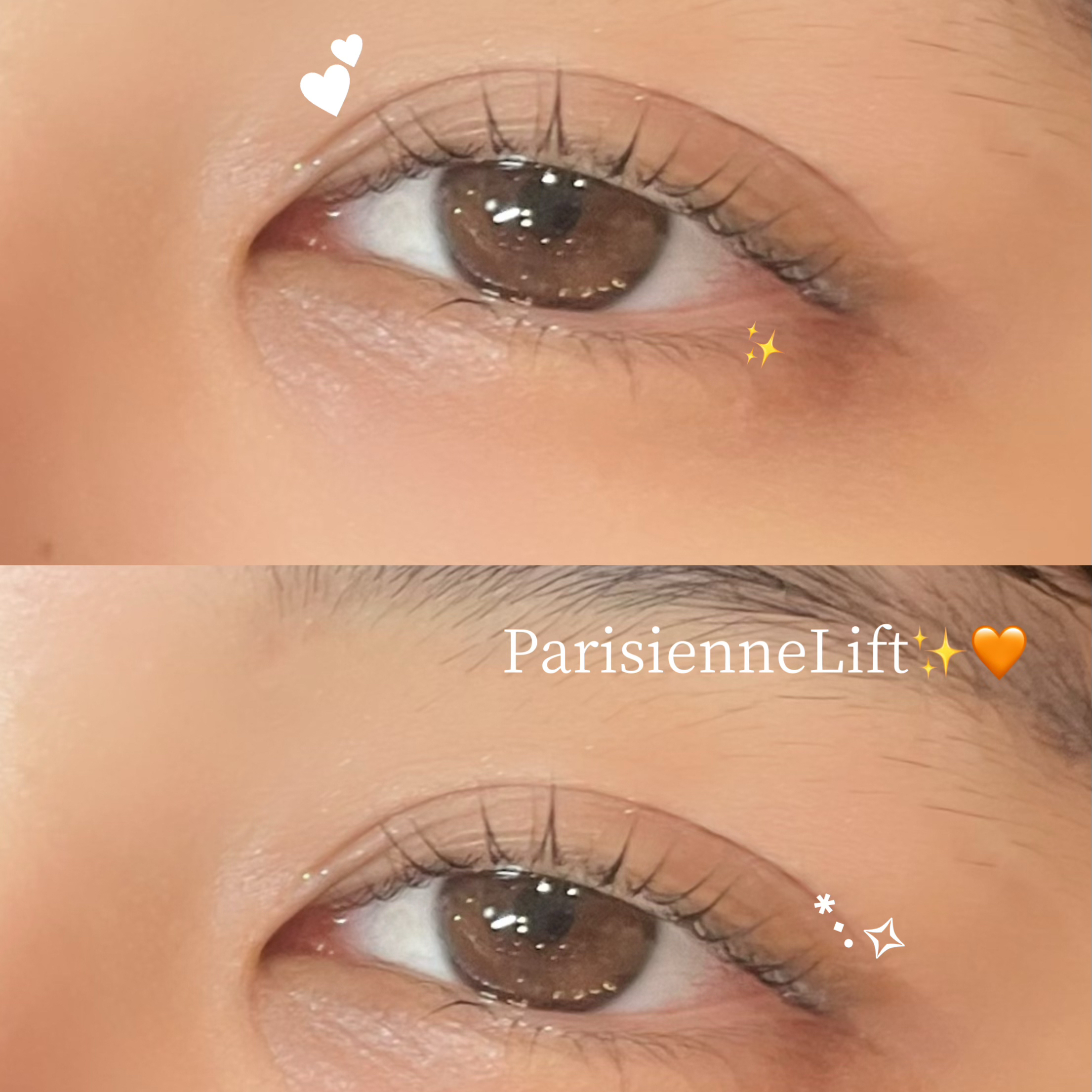 miina_trueye