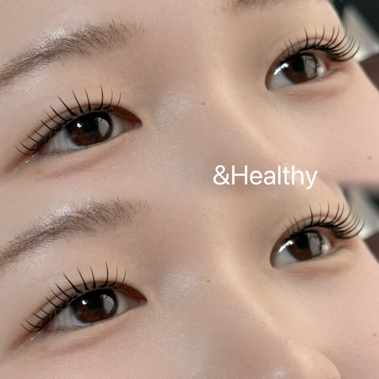 R_LASH