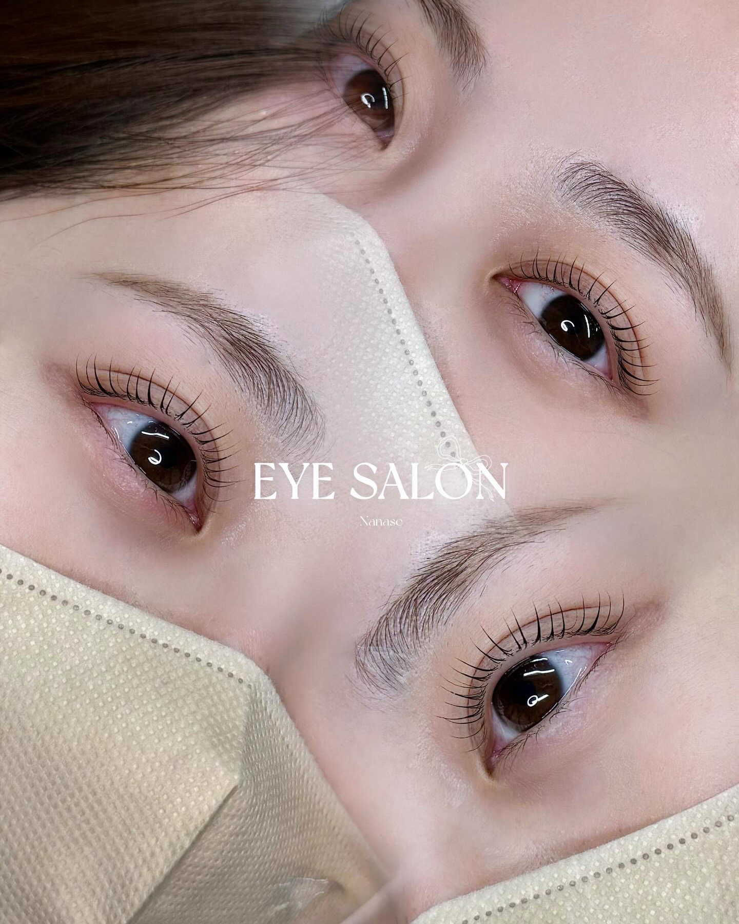N_eye_