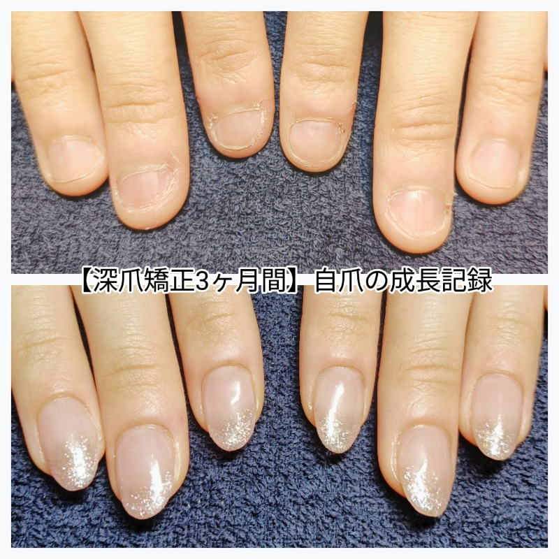 mani_e_nail
