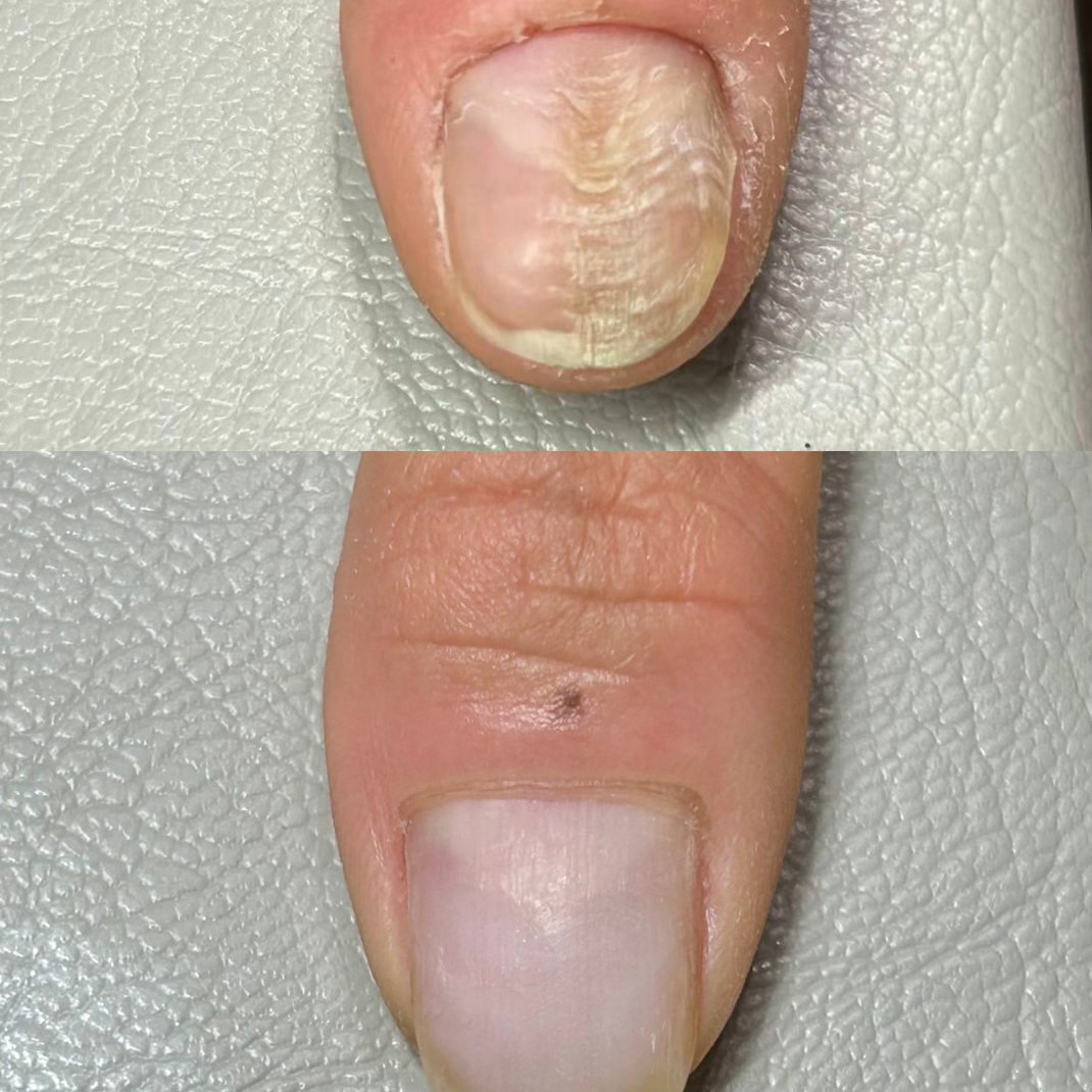 raik_nail