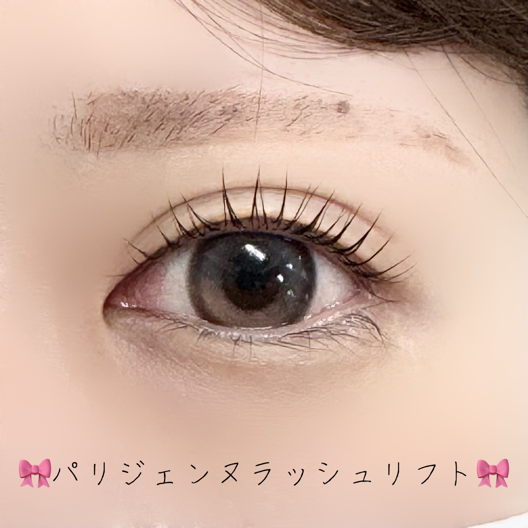 hinata_trueye