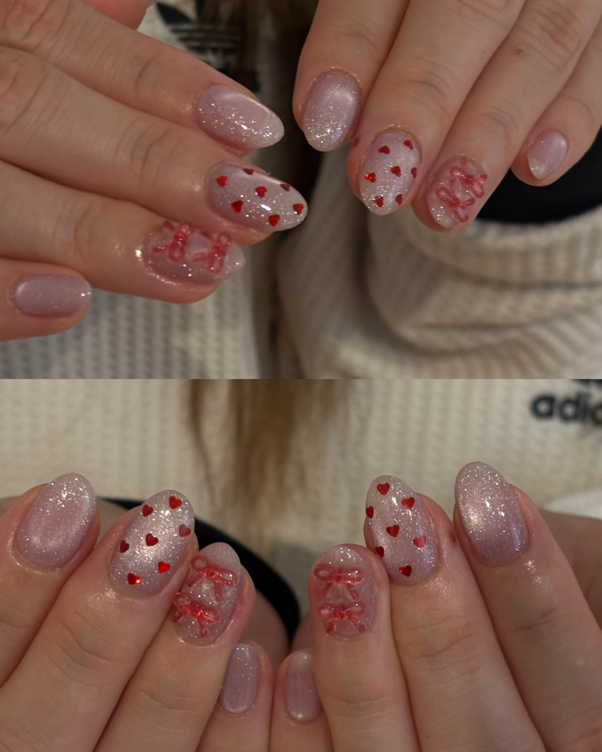 Nup_nail