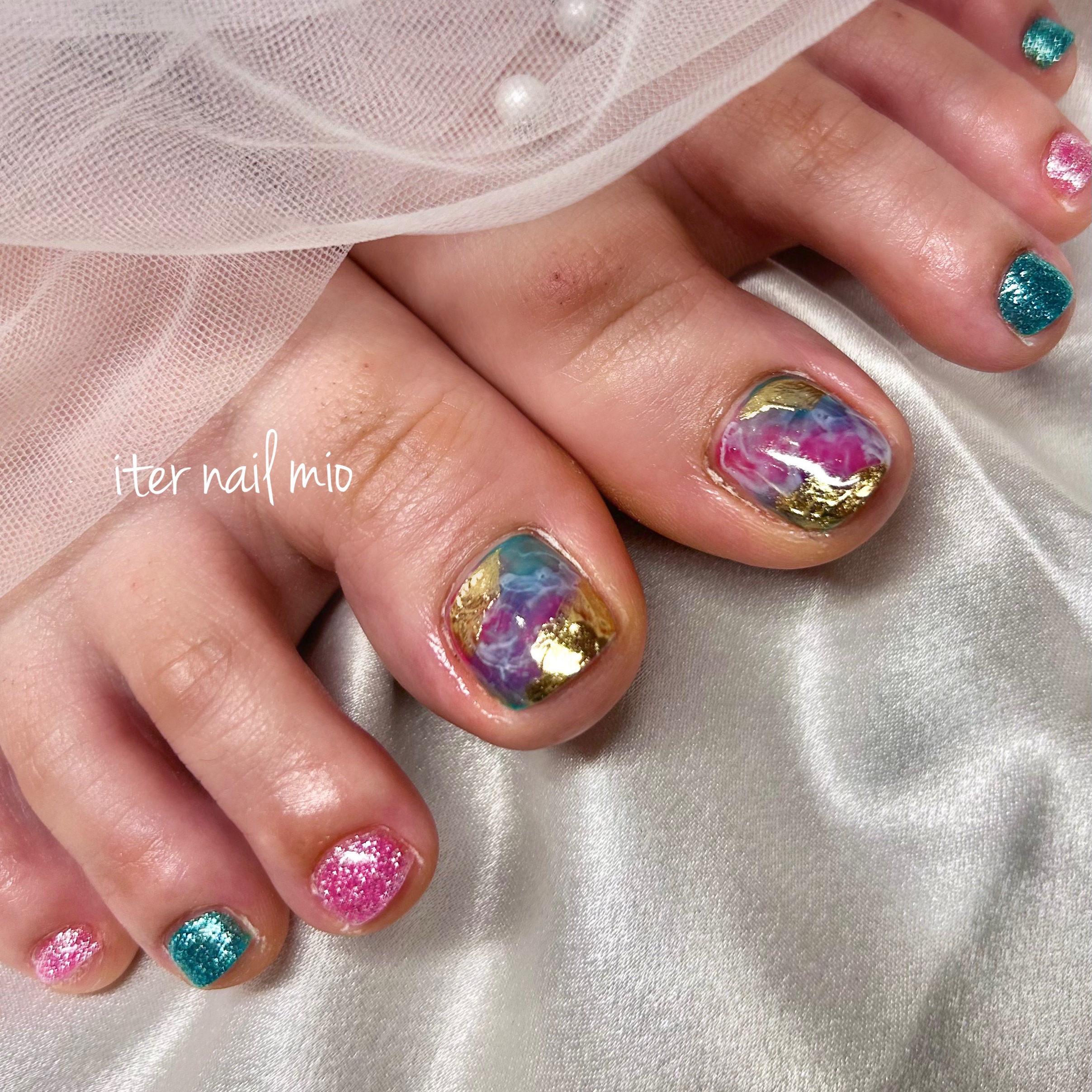 iter_nail_mio