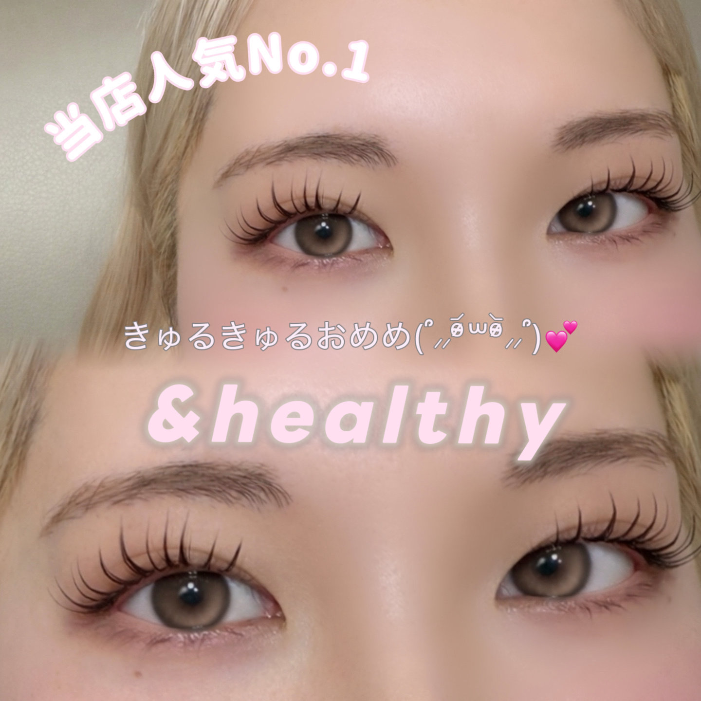 eye___n.t.k