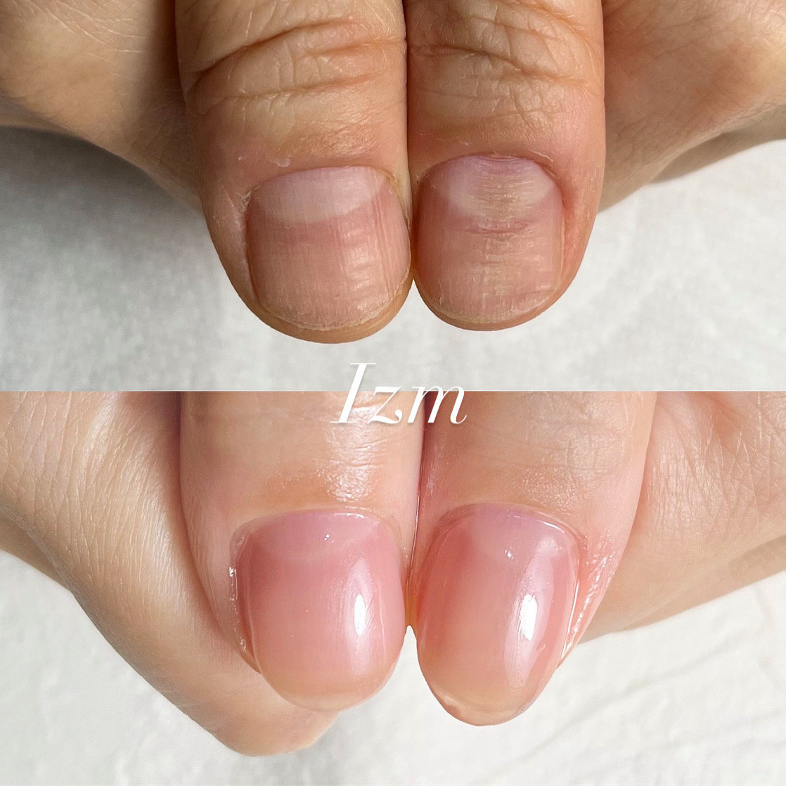 nail_izm