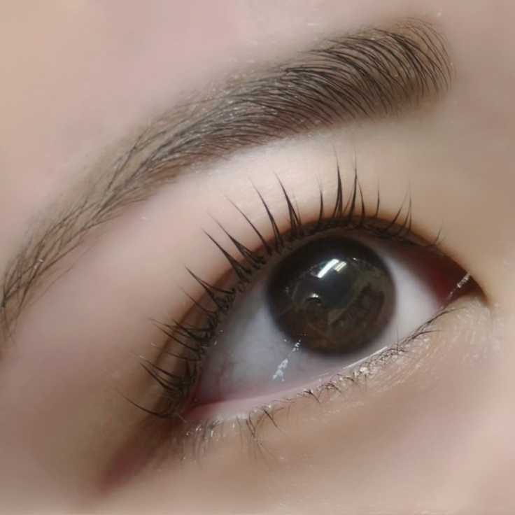 aoi__trueye