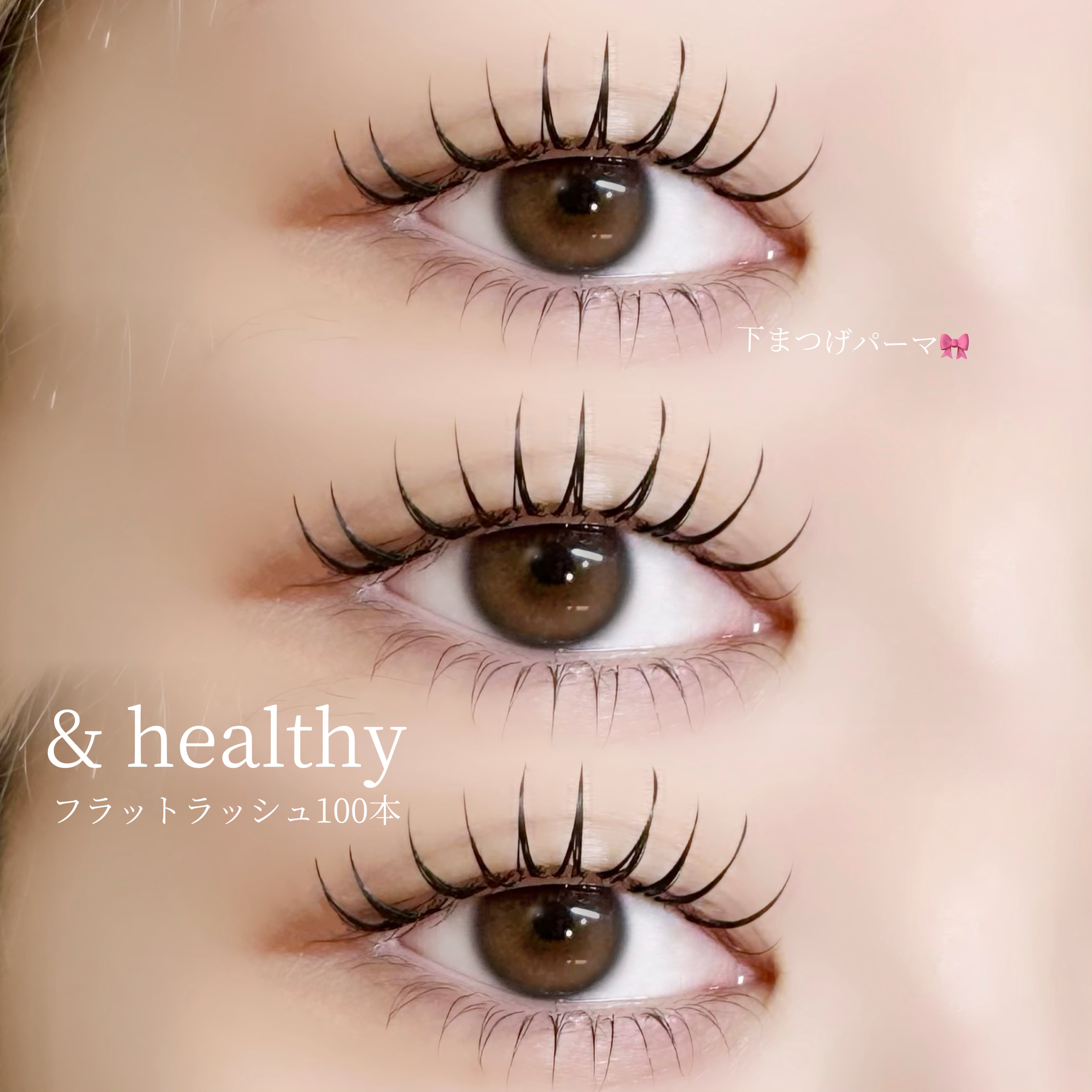 08_ssr