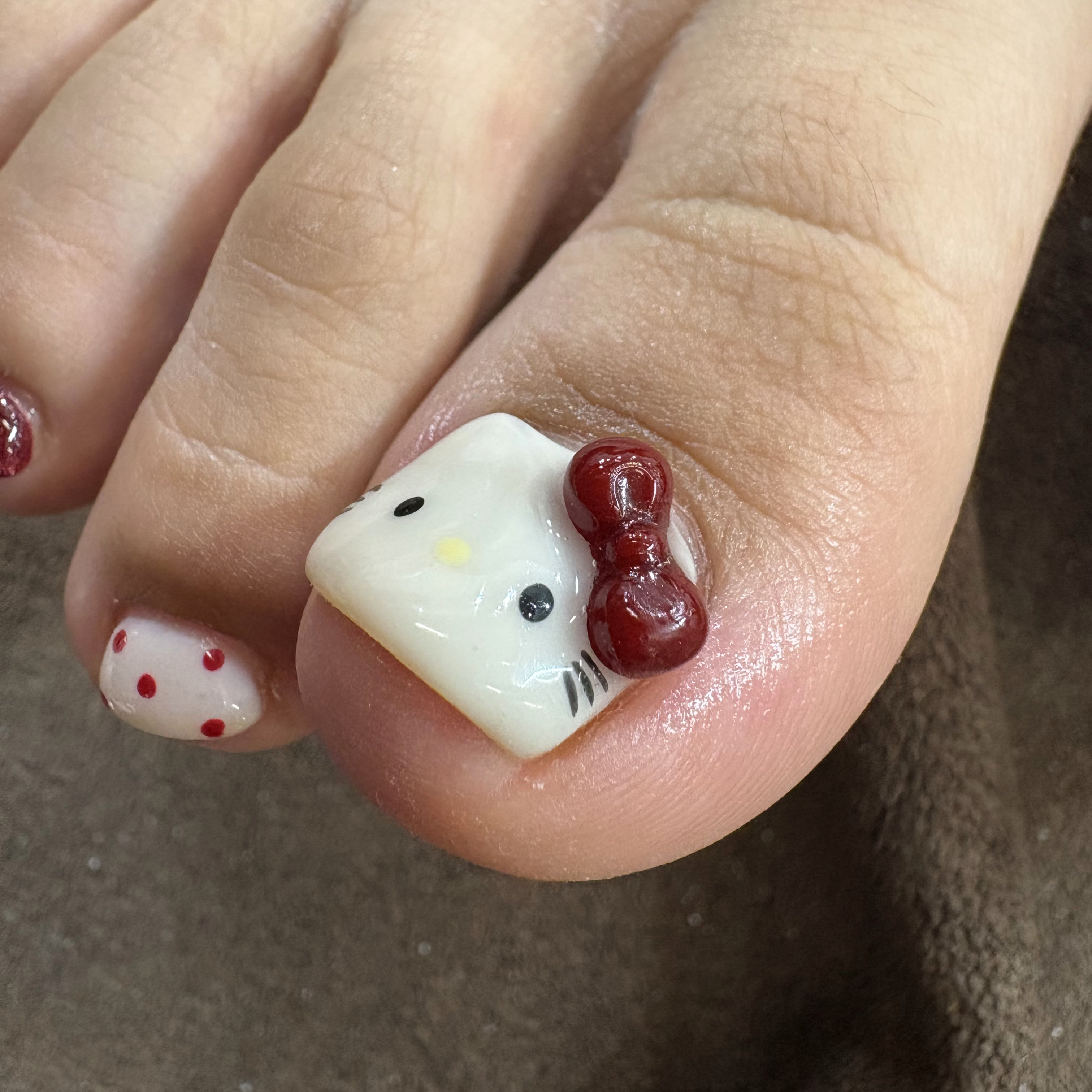 NAIL_Kannna