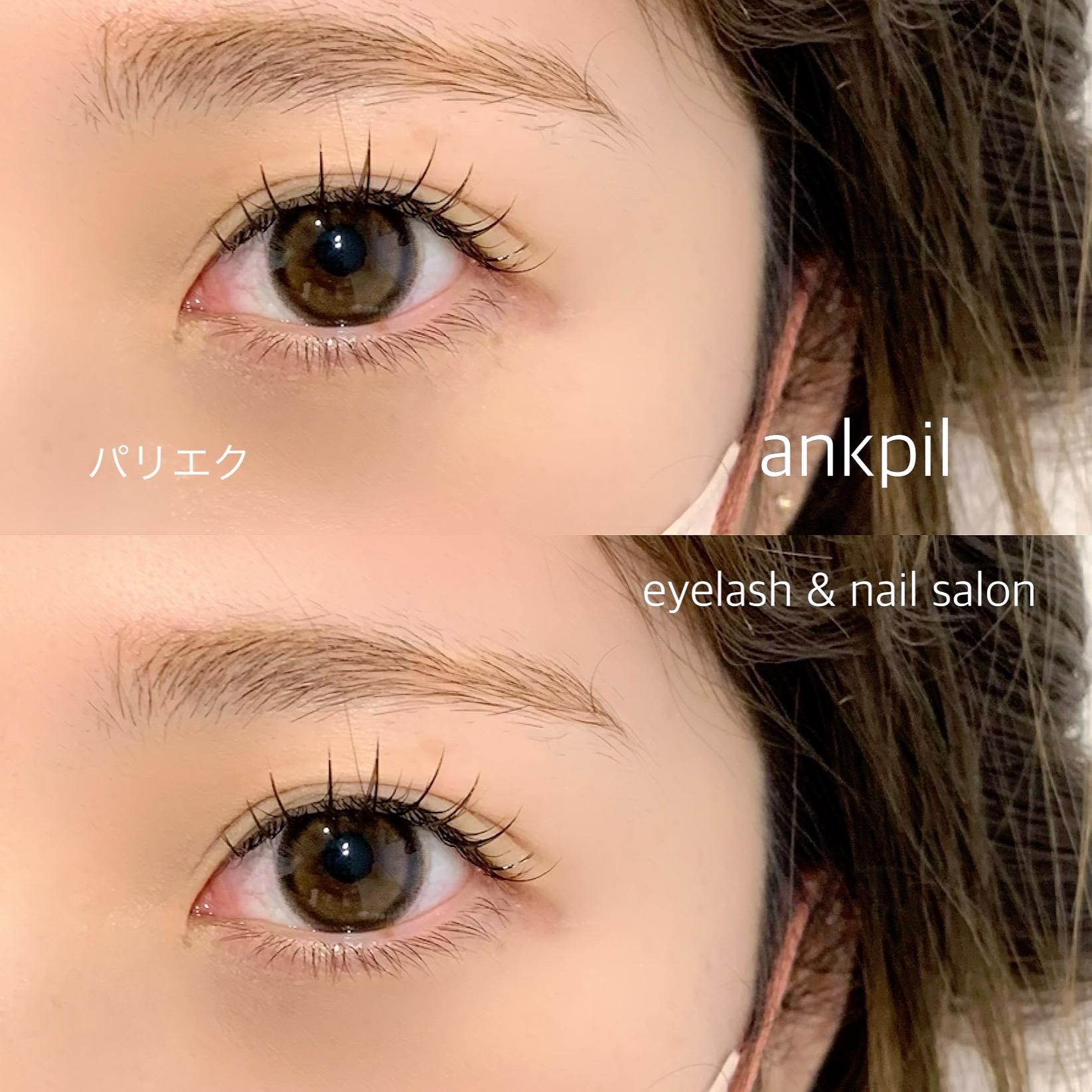 ankpil___yuumi