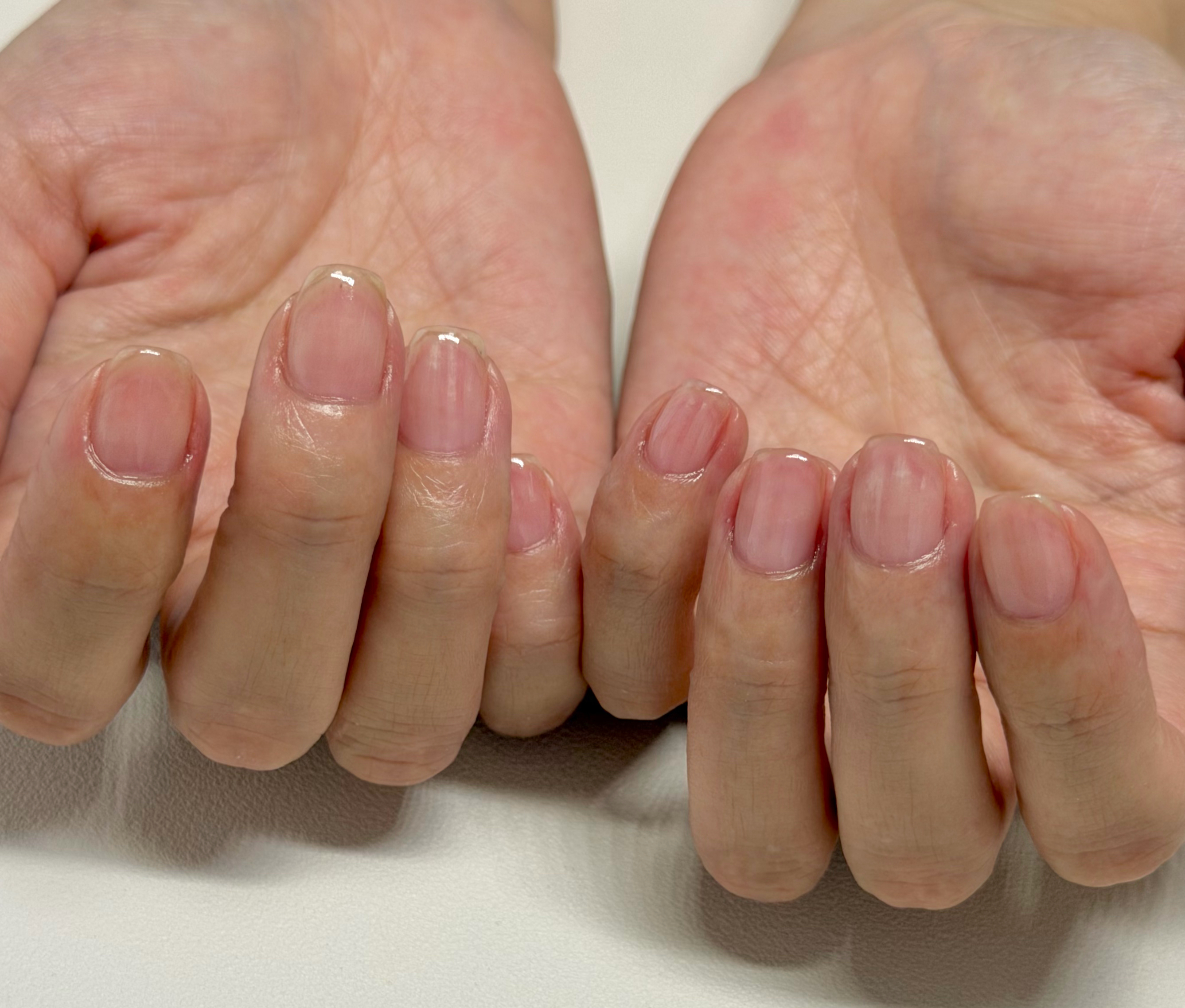 Nail__Lino