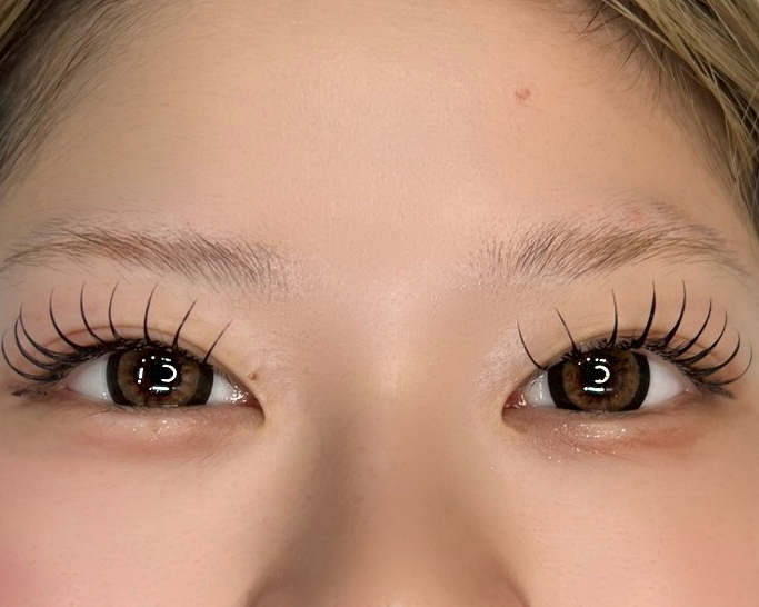 soome_eyeskin