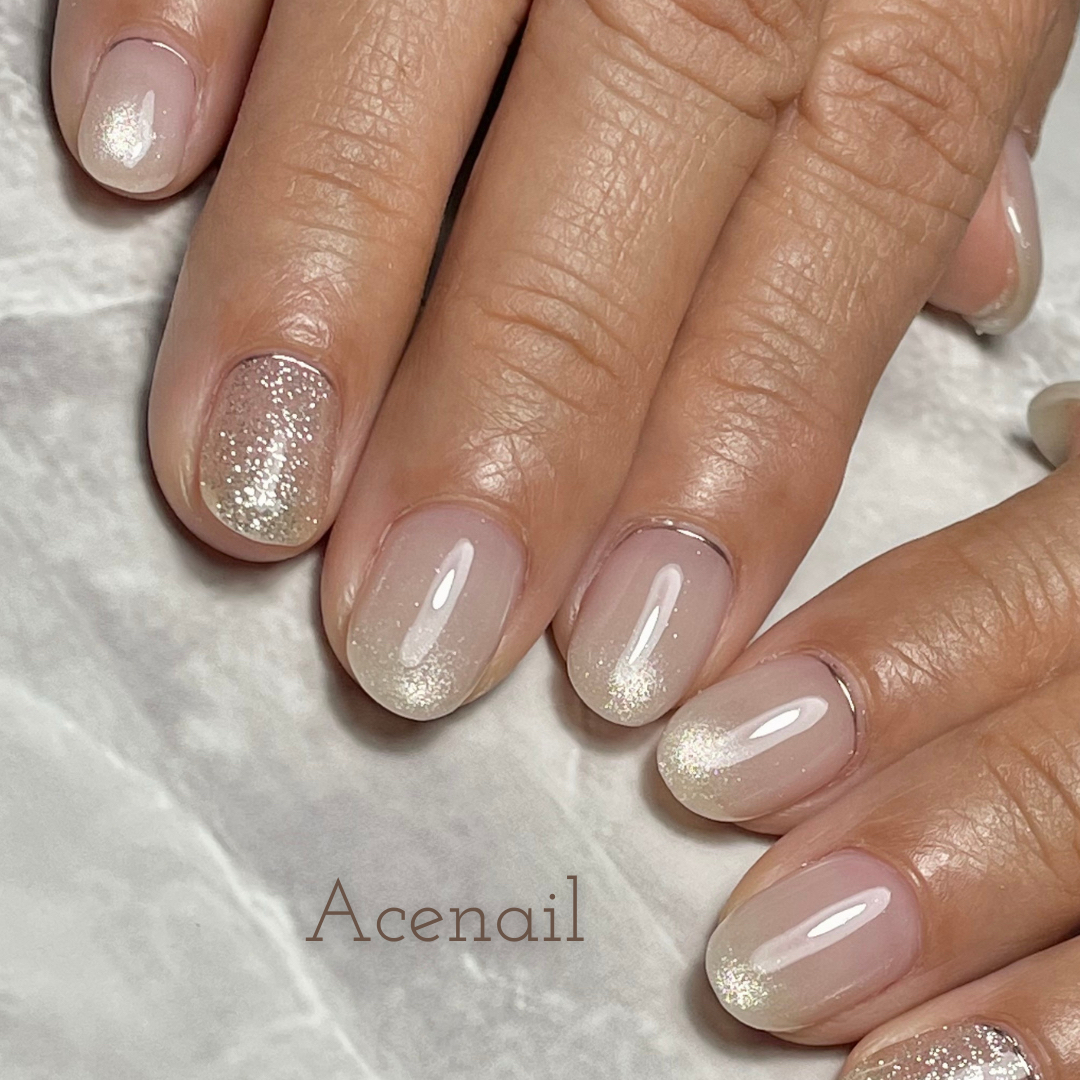 Acenail