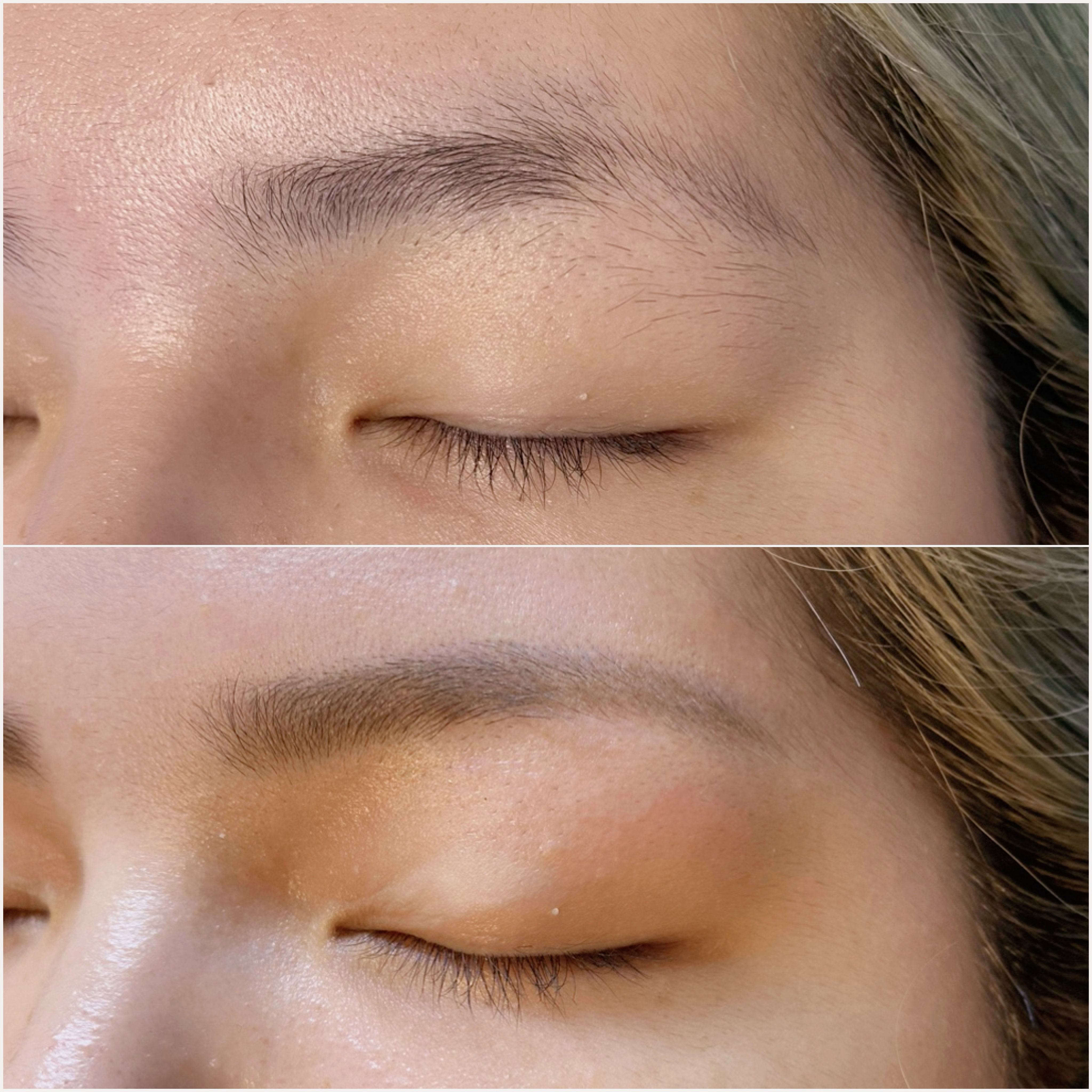eyelist_aico