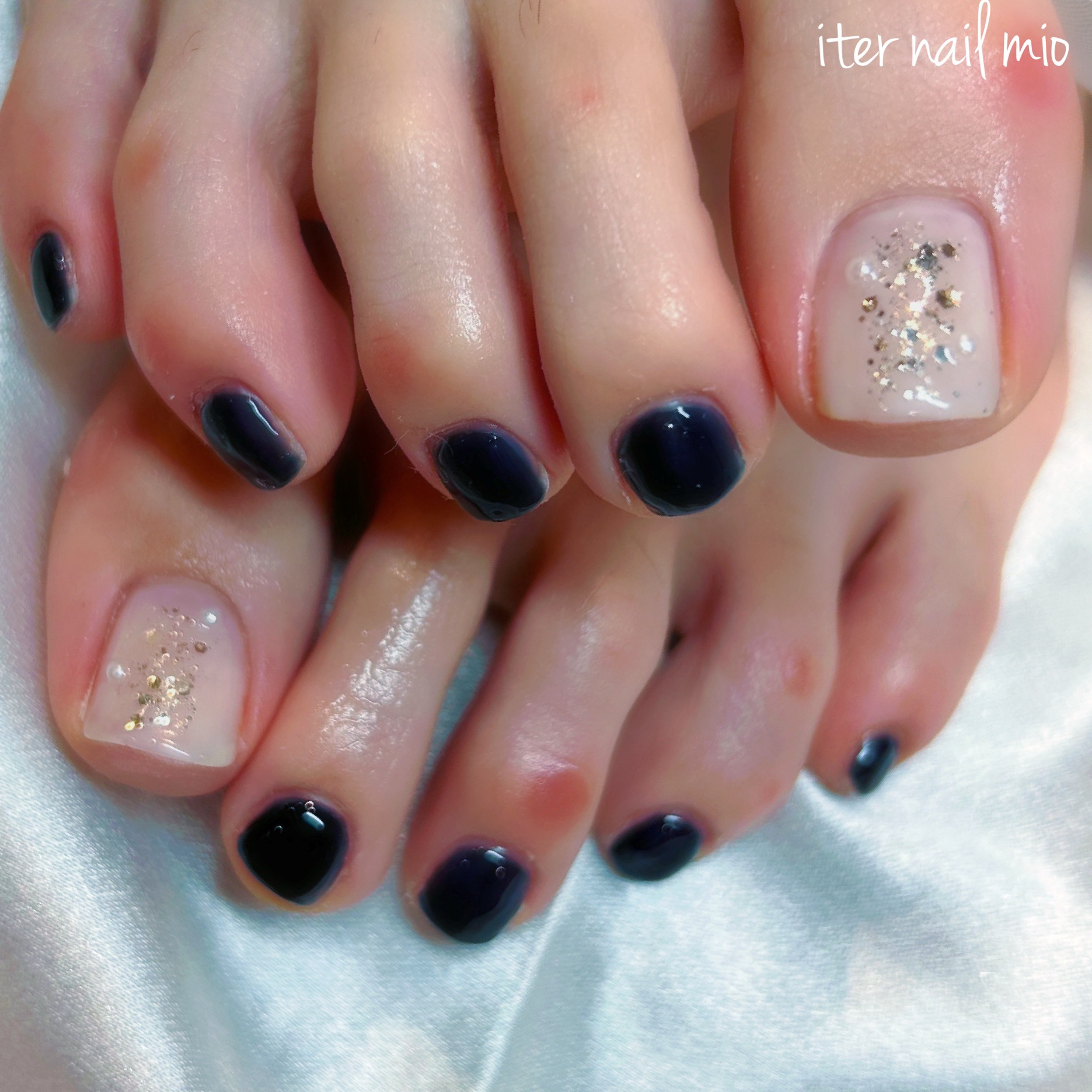 iter_nail_mio