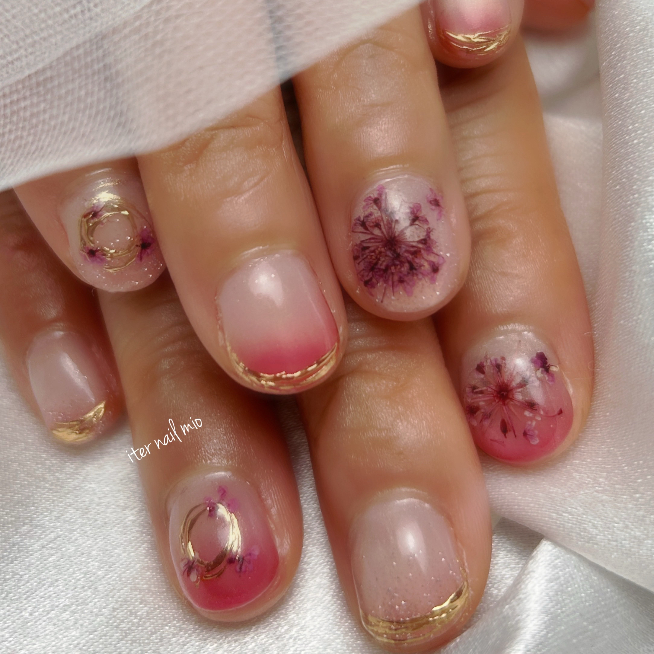 iter_nail_mio