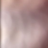 79_nail