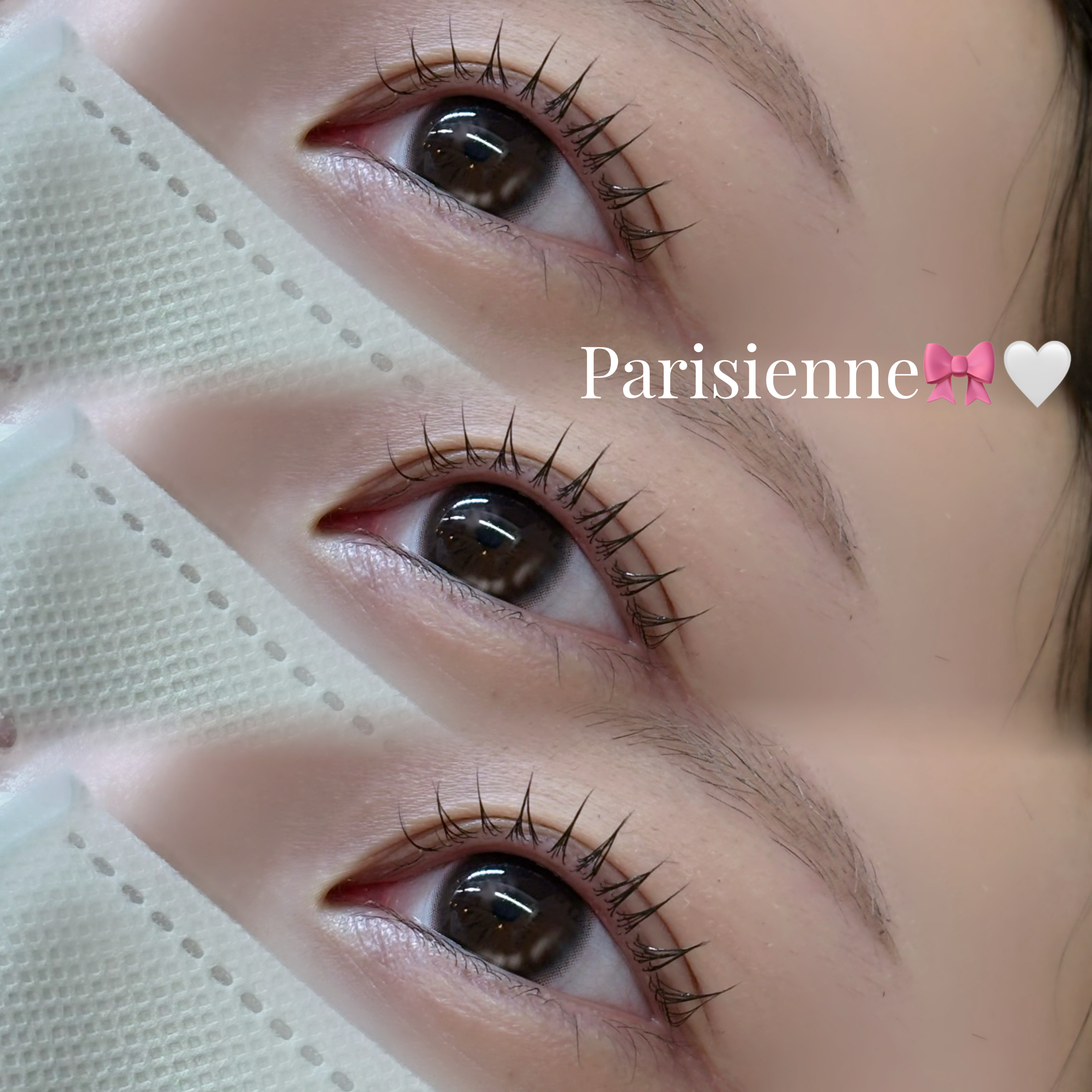 t.rin_trueye
