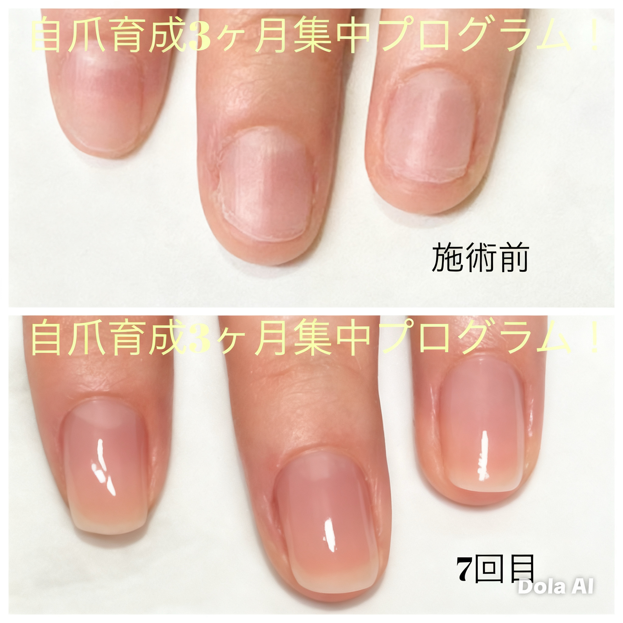Rejuvenail