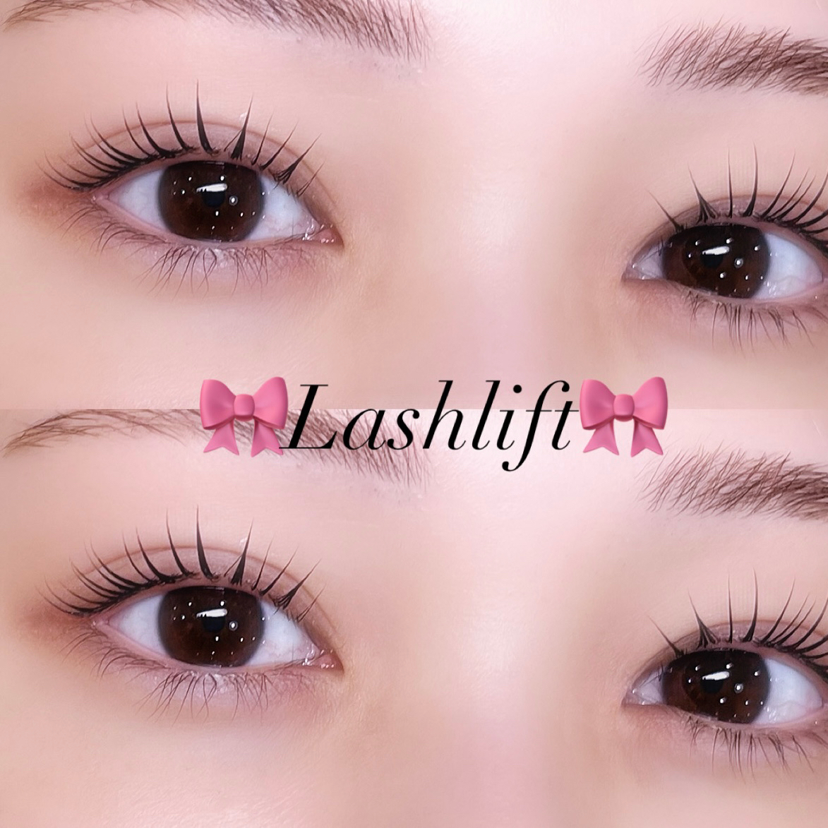 mei_trueye