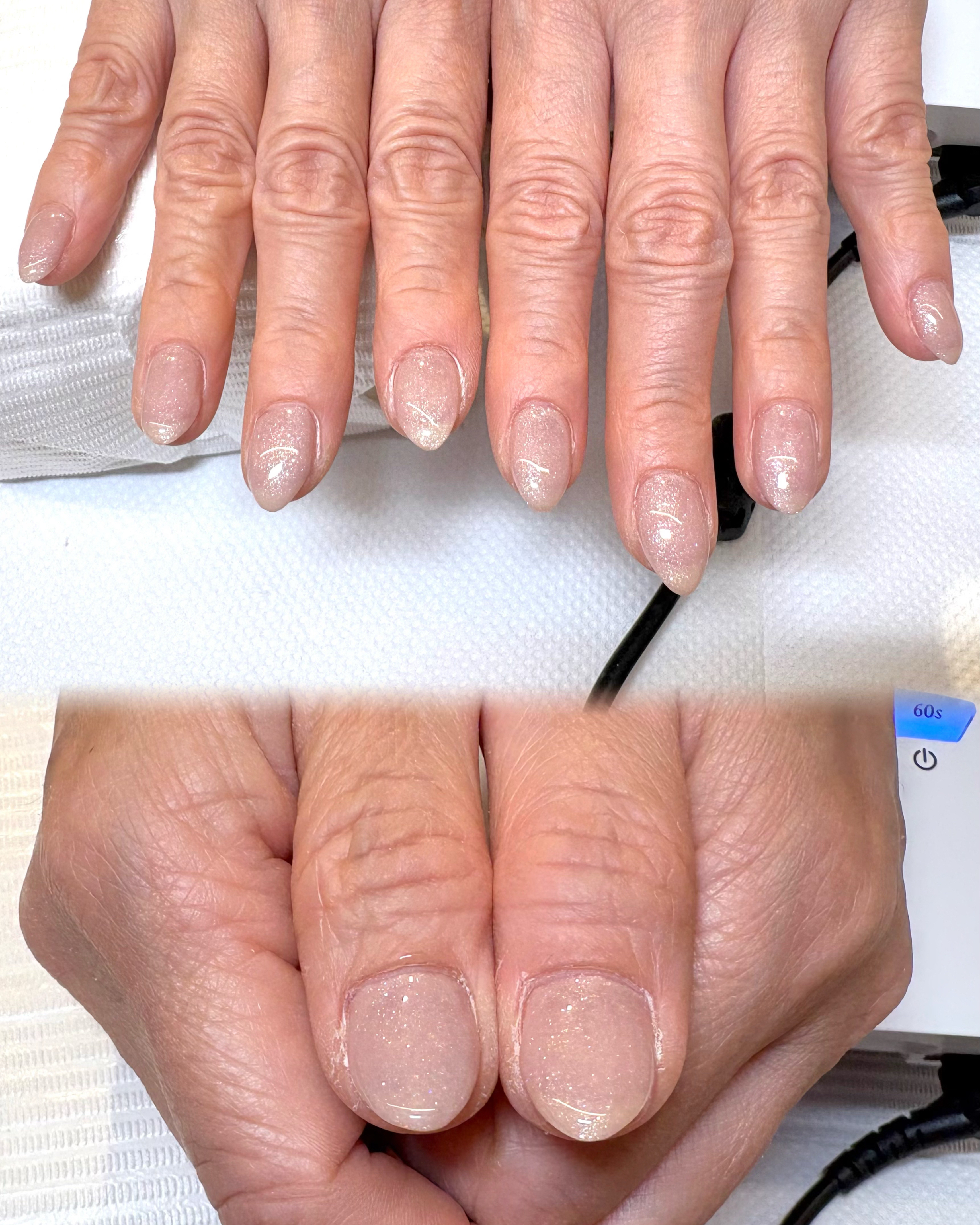 10mo_nail