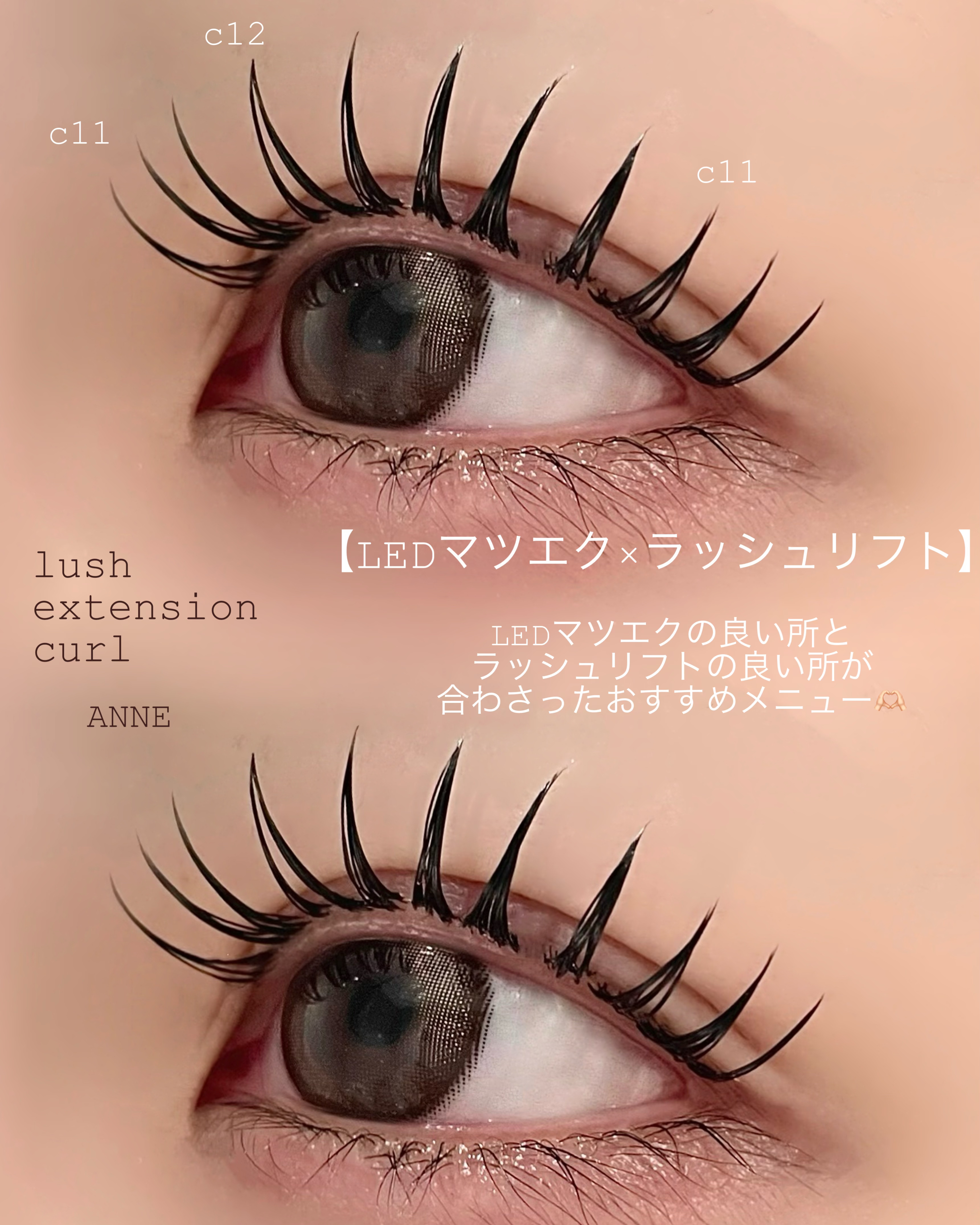 anne_chizu