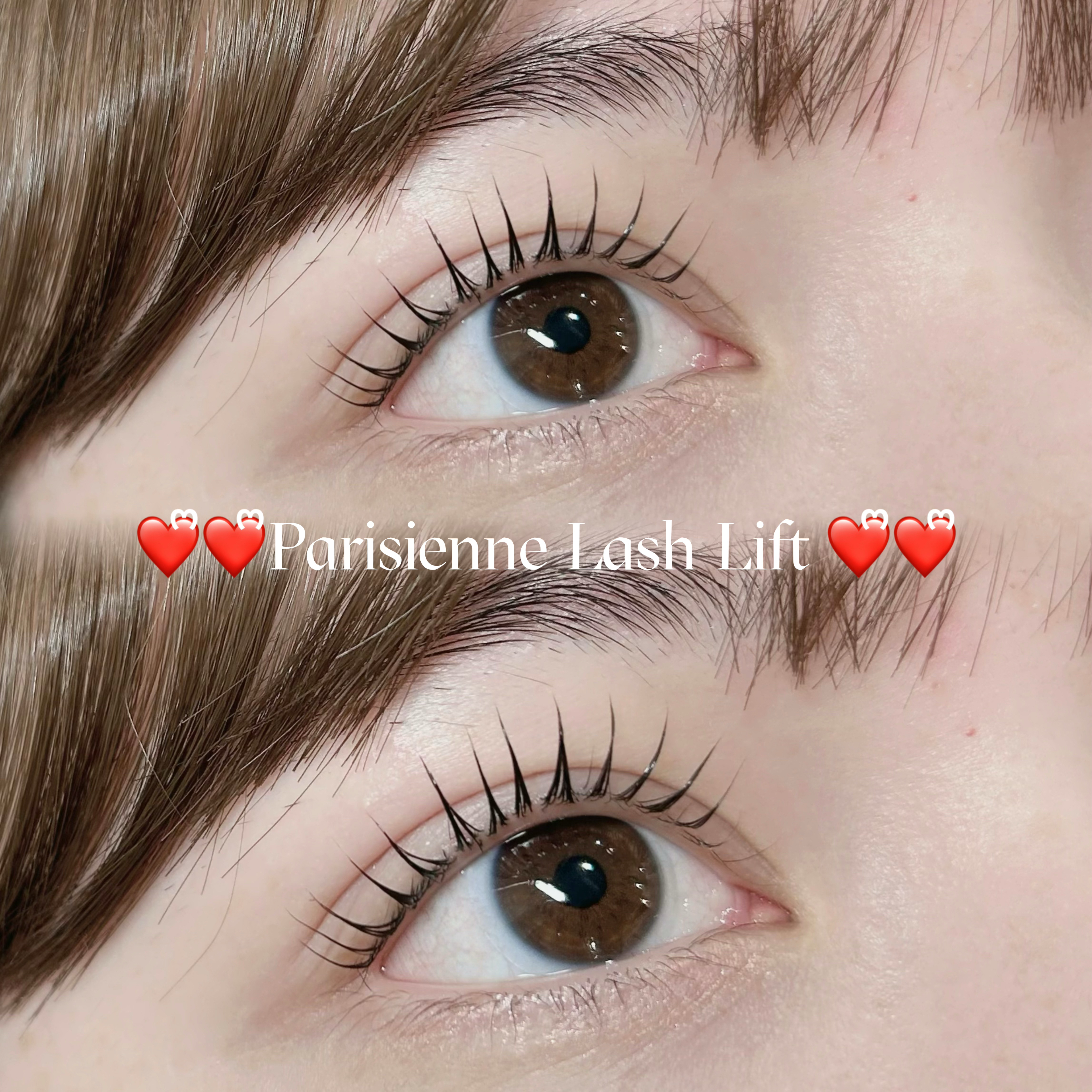mio_trueye