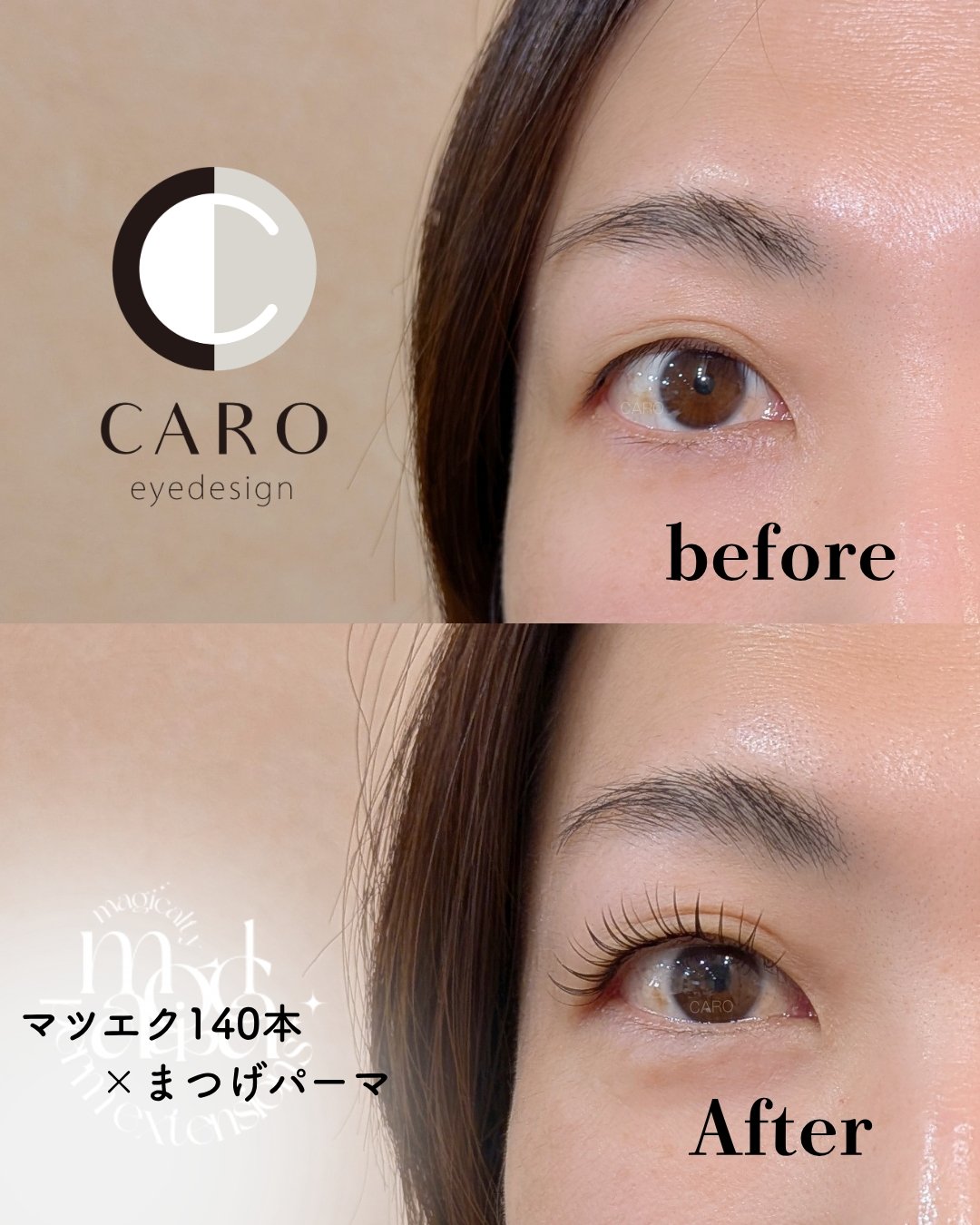 CARO_suita