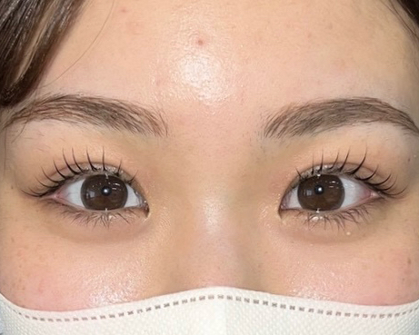 soome_eyeskin