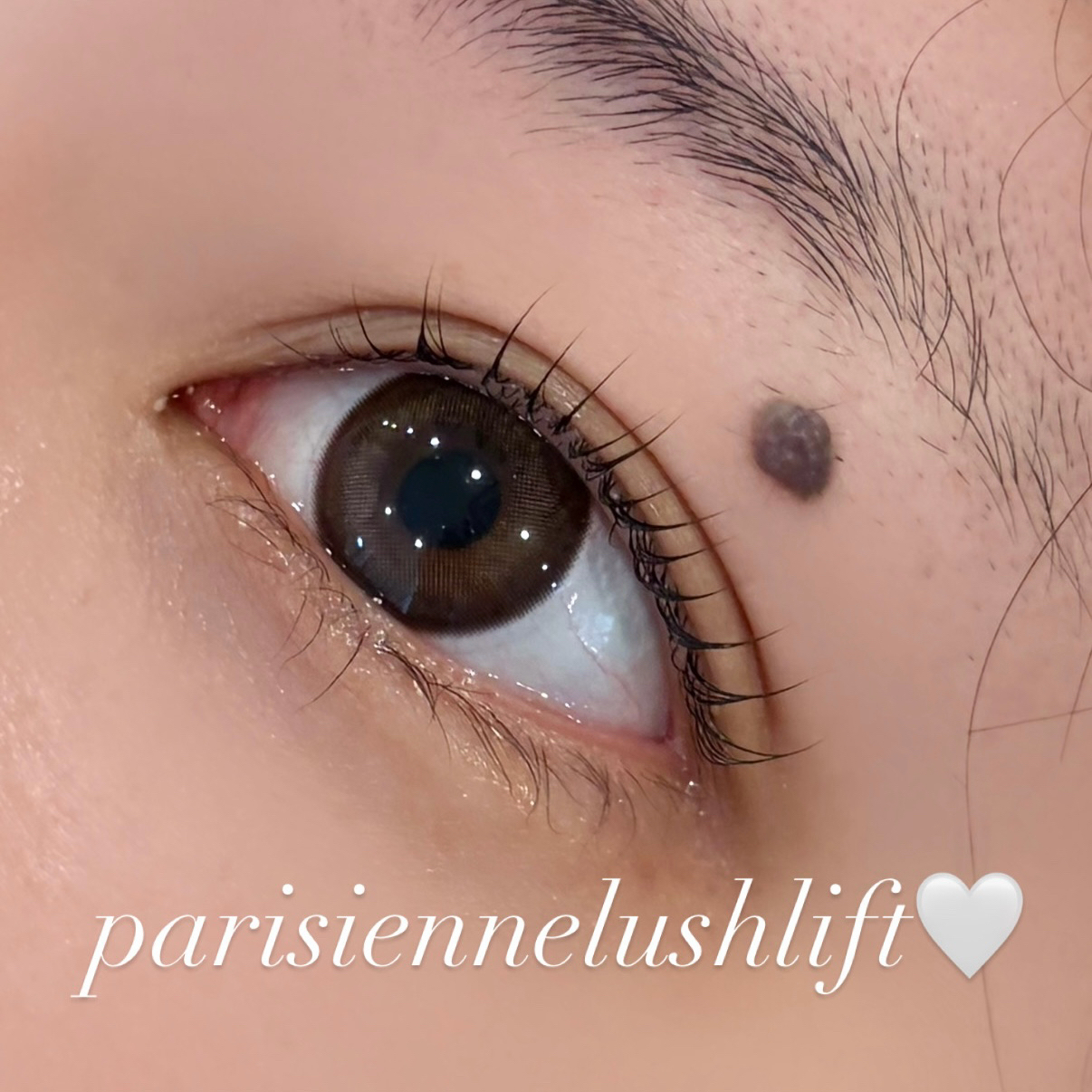 runa._trueye