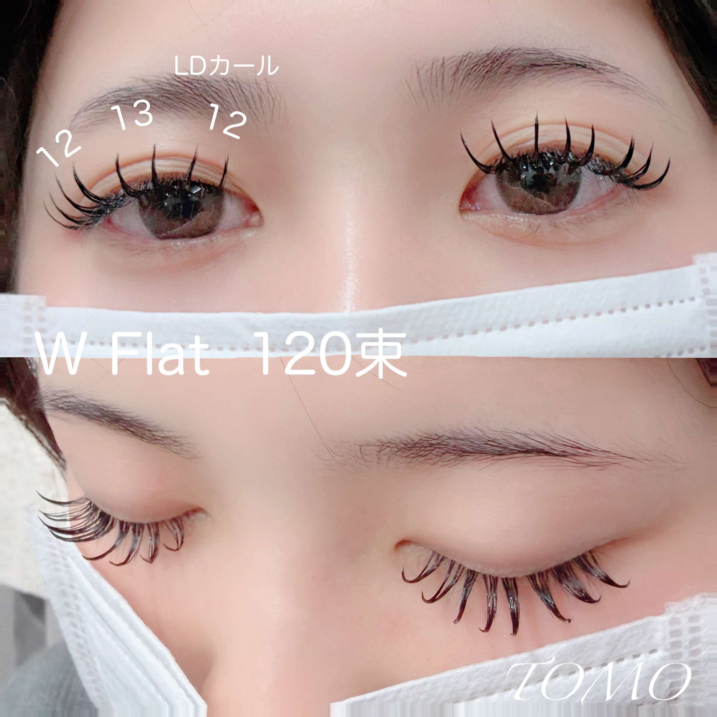 tomo_eye