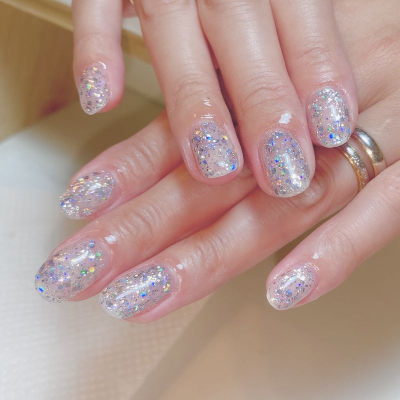 M-nail