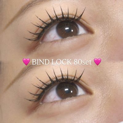 バインドロック 80セット
