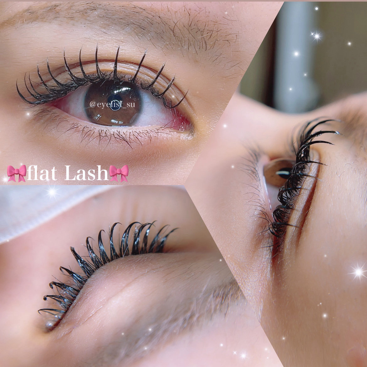 eye_su