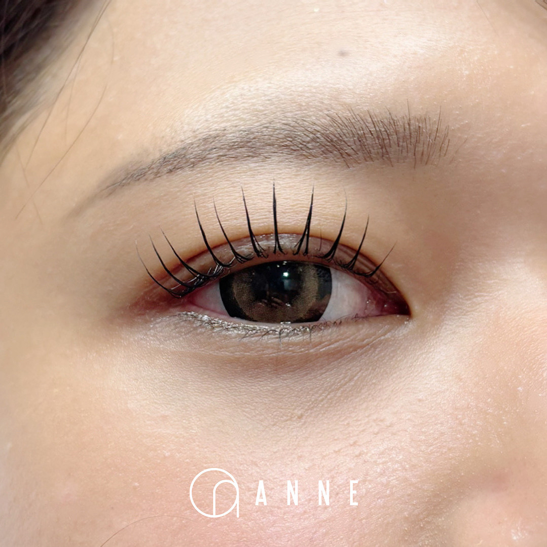 ANNE_akn