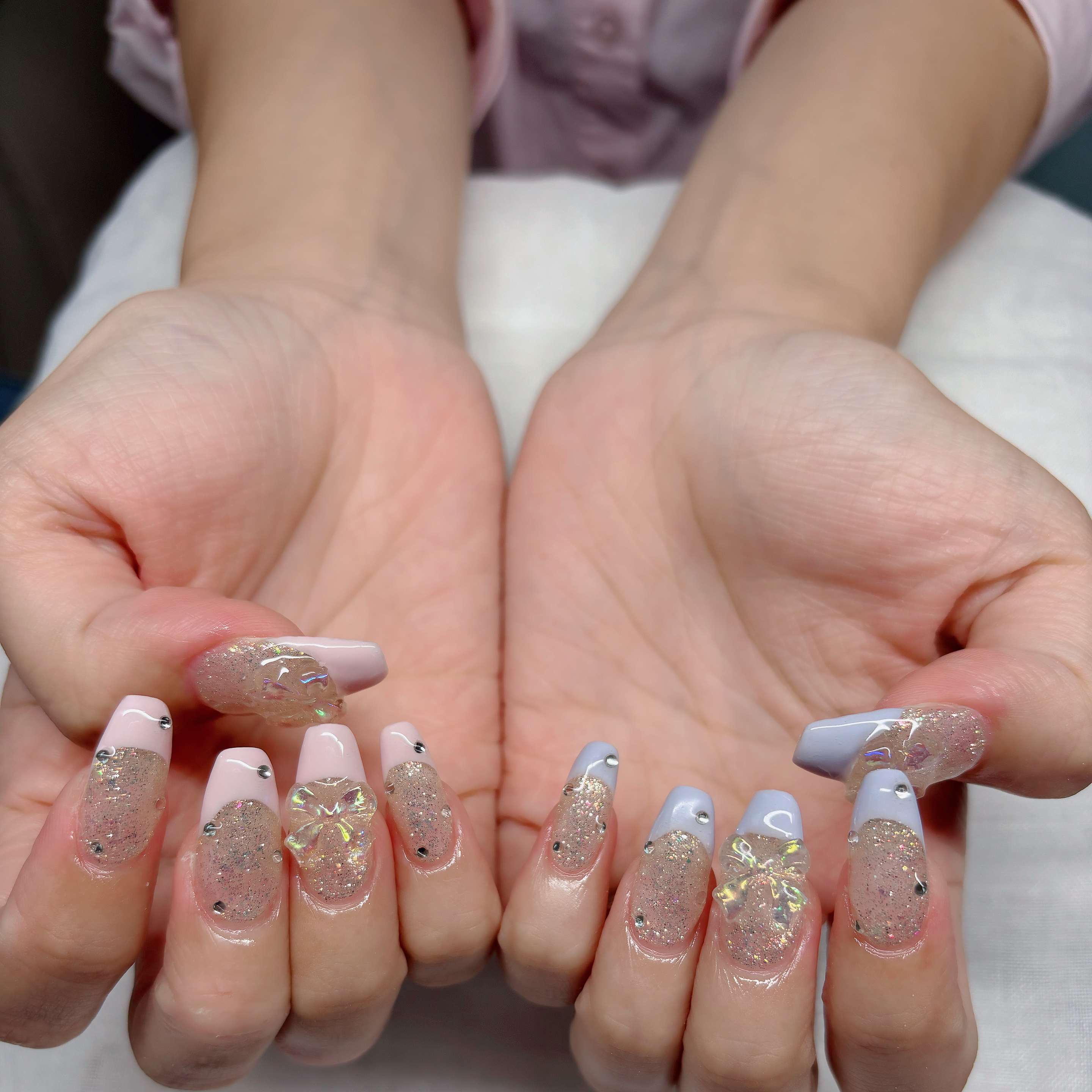trangnail