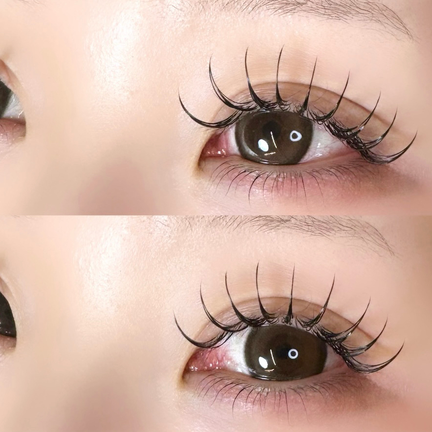 eye___ramu