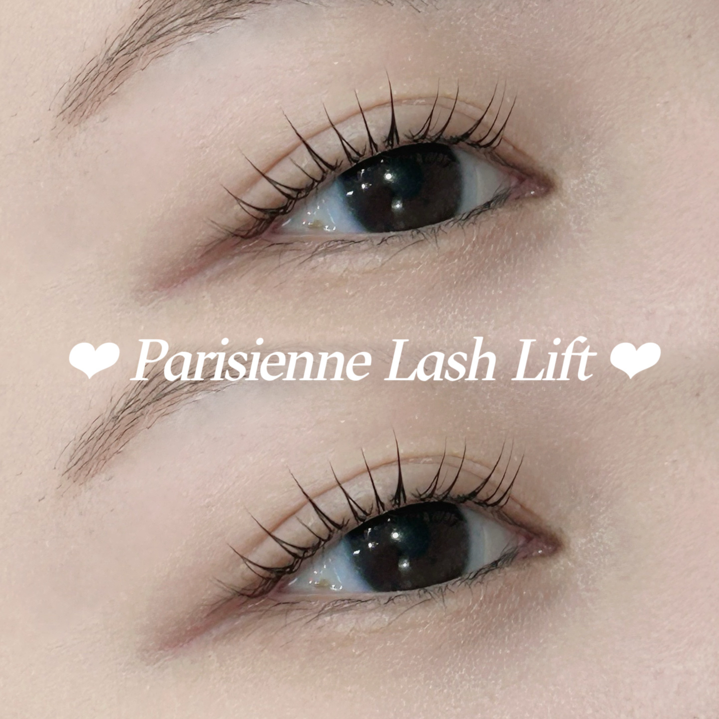 mio_trueye