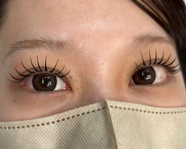 soome_eyeskin