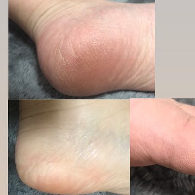 ガサガサ卒業‎💗フットケア‎でふわふわな足に...꙳⟡