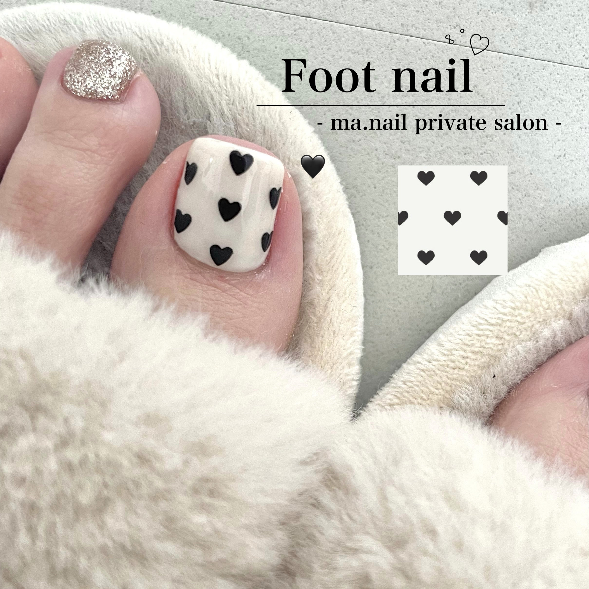 ma.nail