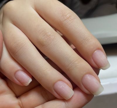 自爪オフのみ