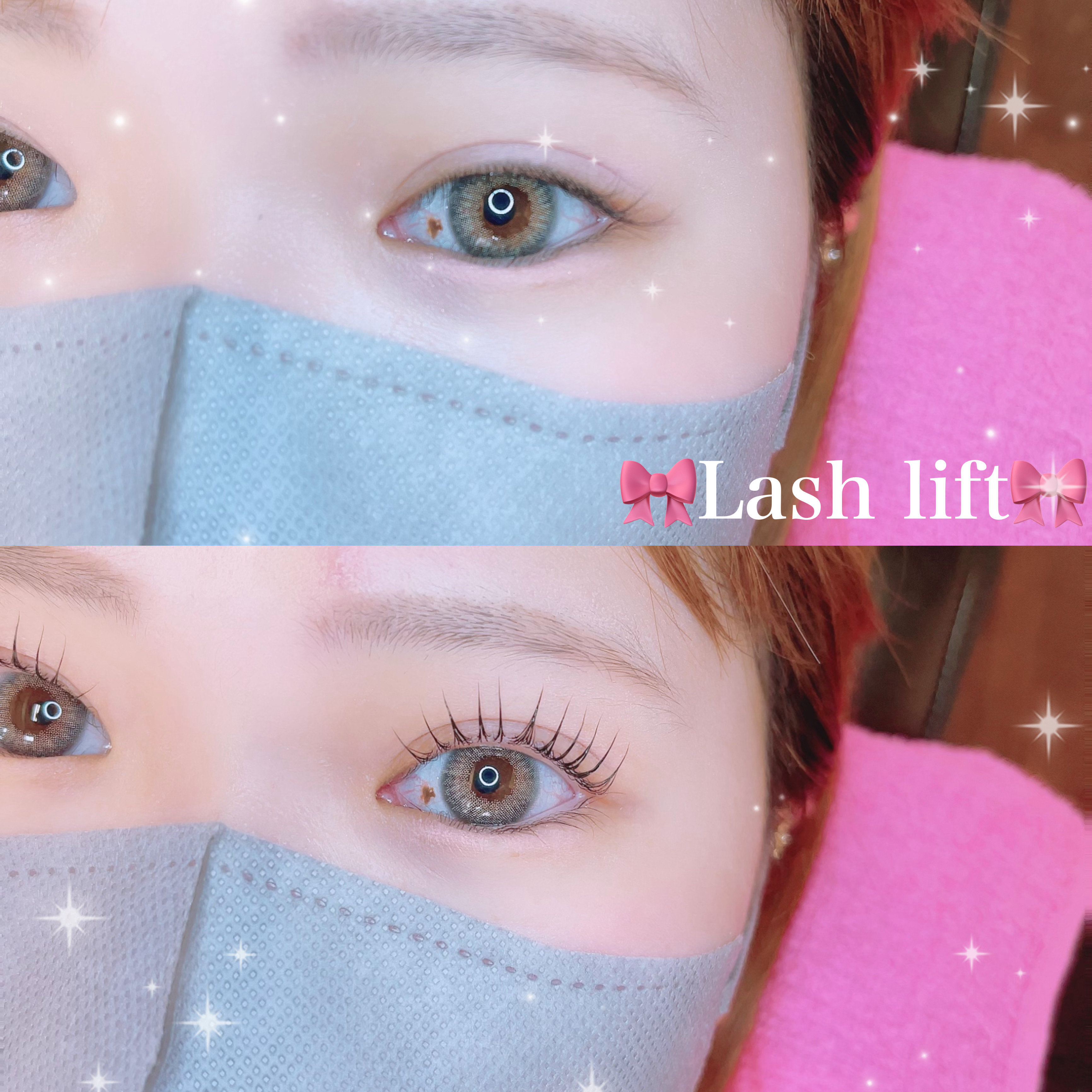 eye_su