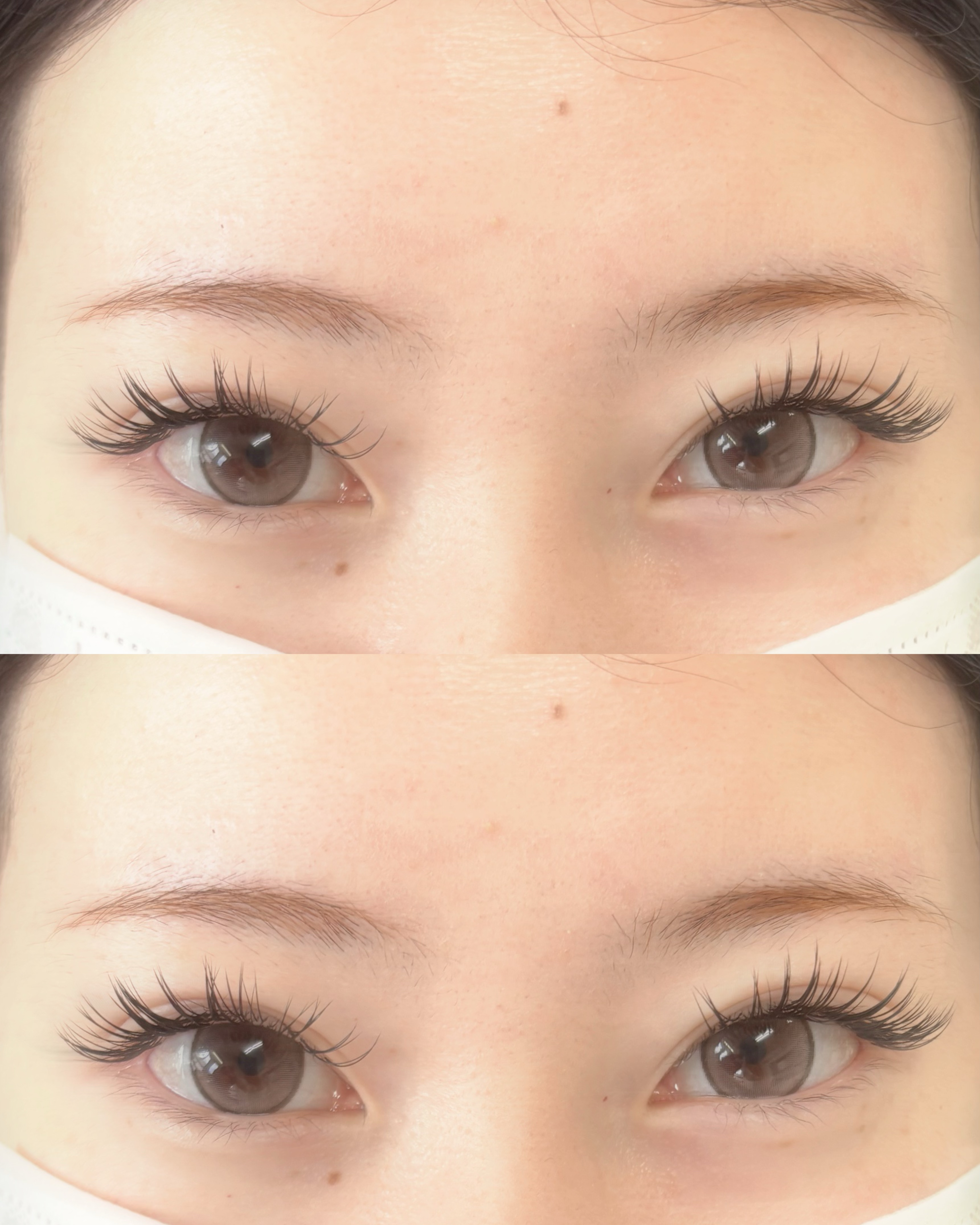 aoi__trueye