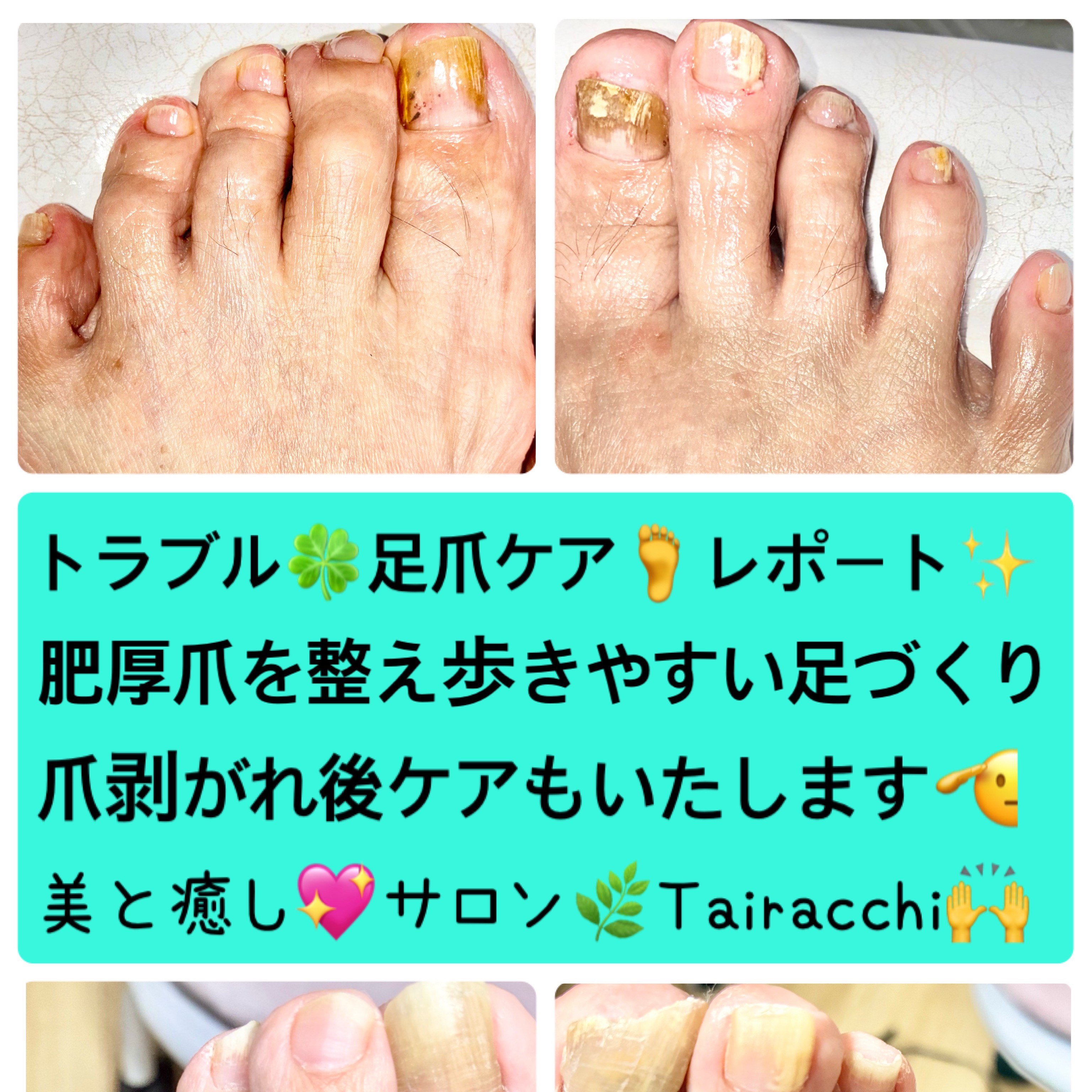 Tairacch_