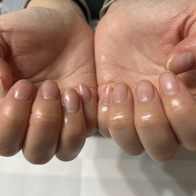 自爪に戻すため、アセトン使用のオフ