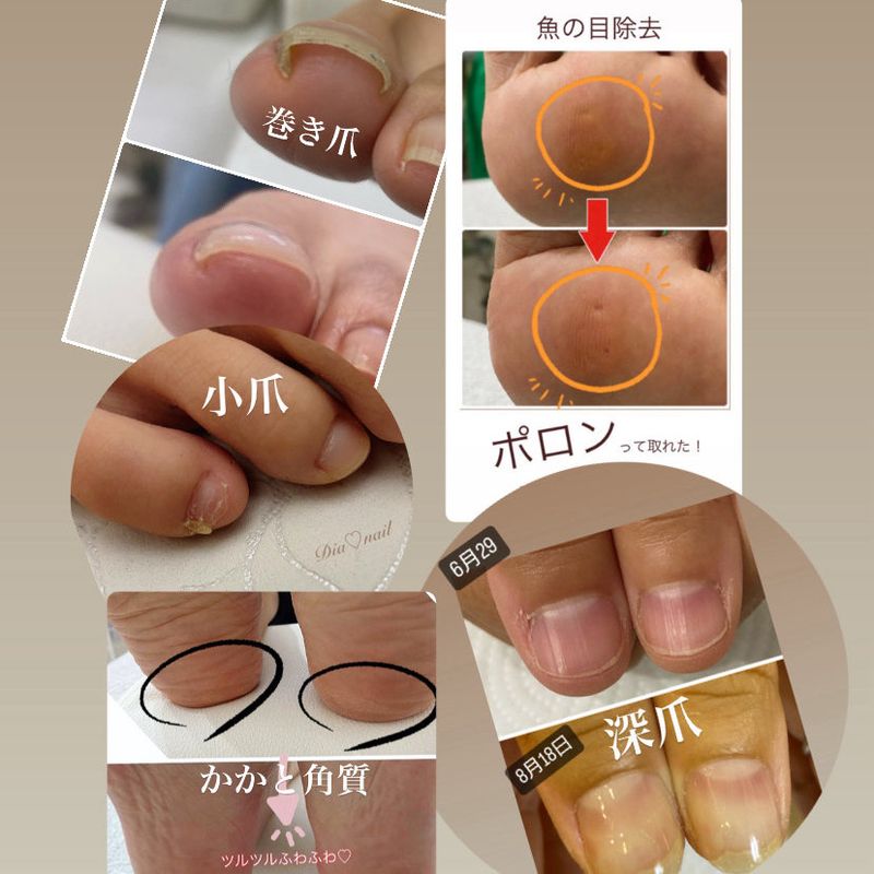 Dia♡nail