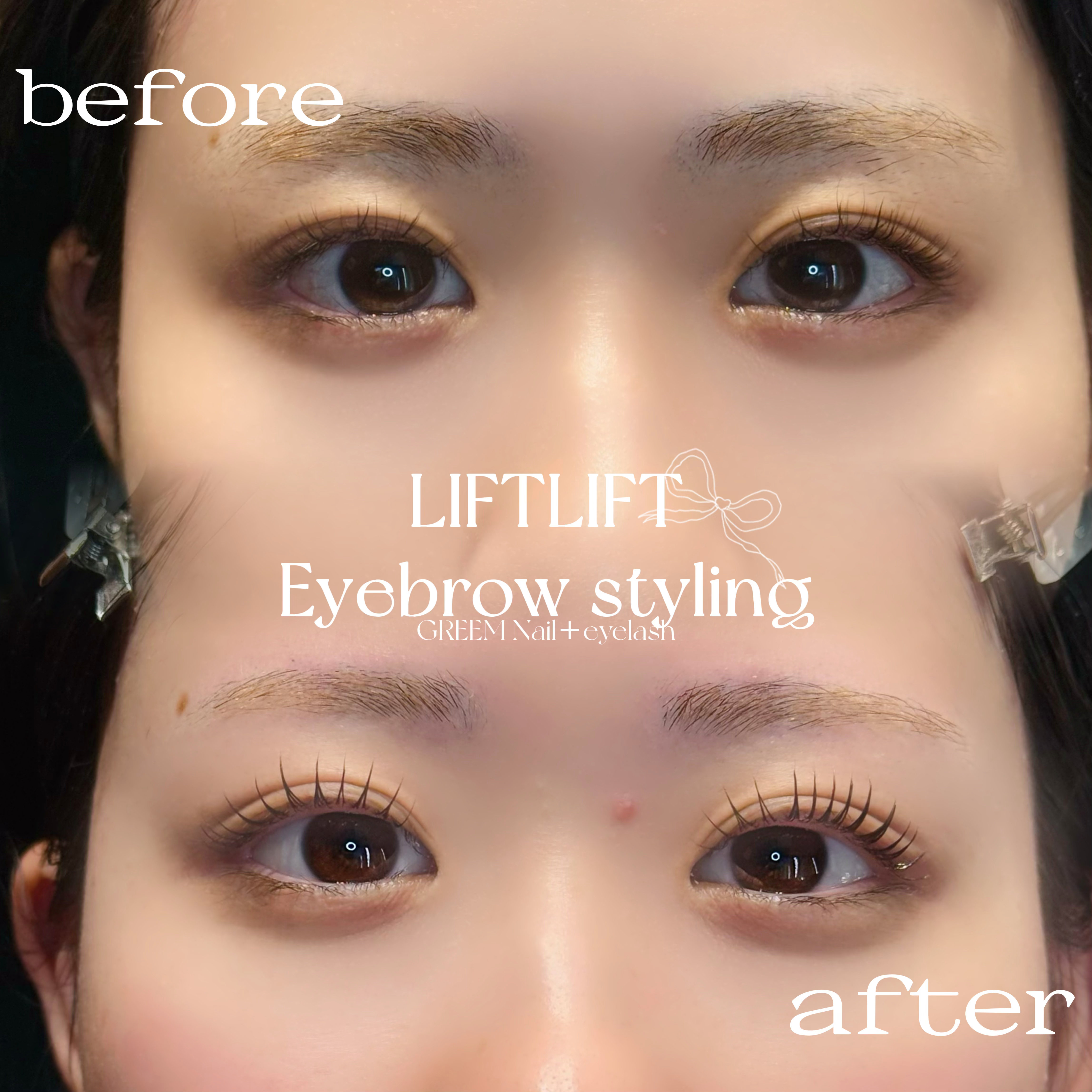 eyelist__chiho