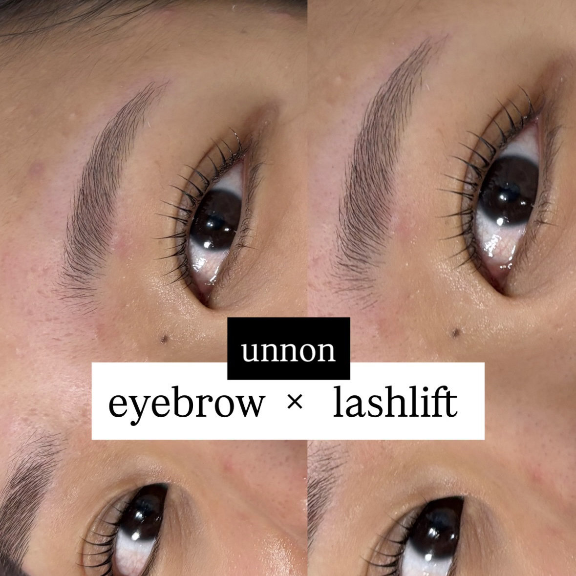 unnon_takeshita